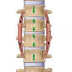 Spine - Instrumentation, Stabilisation
