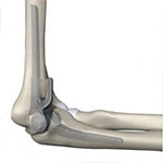 Elbow Joint Replacement Surgery