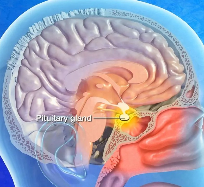 Best Treatment for Endoscopic Pituitary Tumour Excision